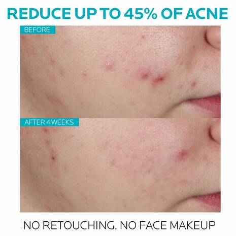 Effaclar Salicylic Acid Acne Treatment Serum 30ml