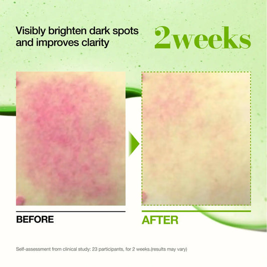 Azelaic Acid 10 Hyaluron Redness Soothing Serum