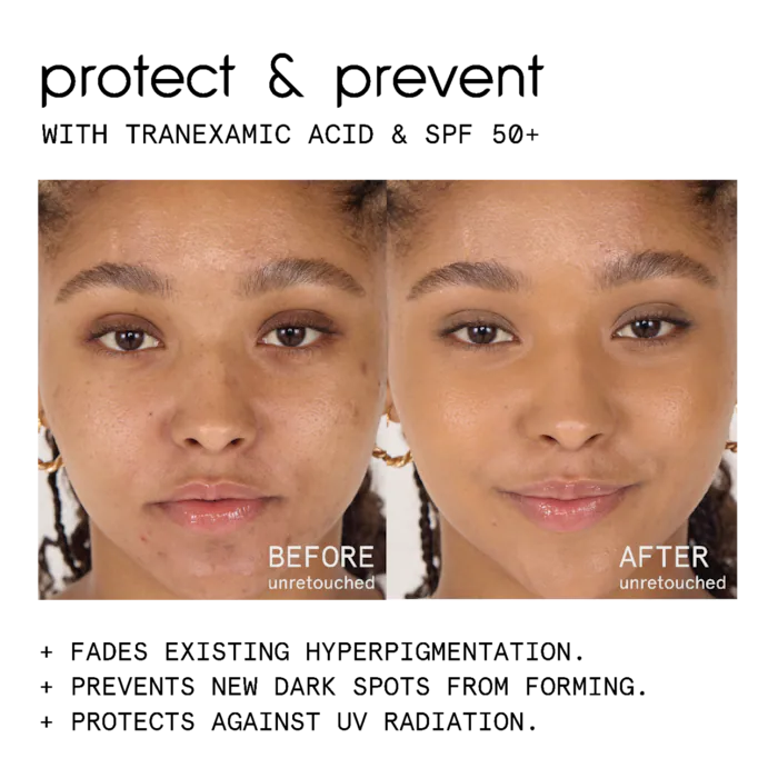 ciele conceal & PROTECT SPF 50+ spot concealer for dark spots
