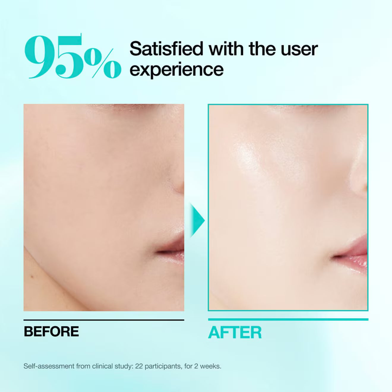 PDRN Hyaluronic Acid Capsule 100 Serum Mask