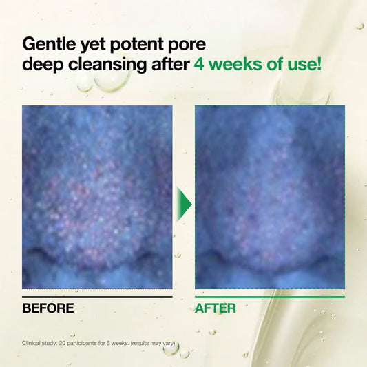 Heartleaf Pore Control Cleansing Oil