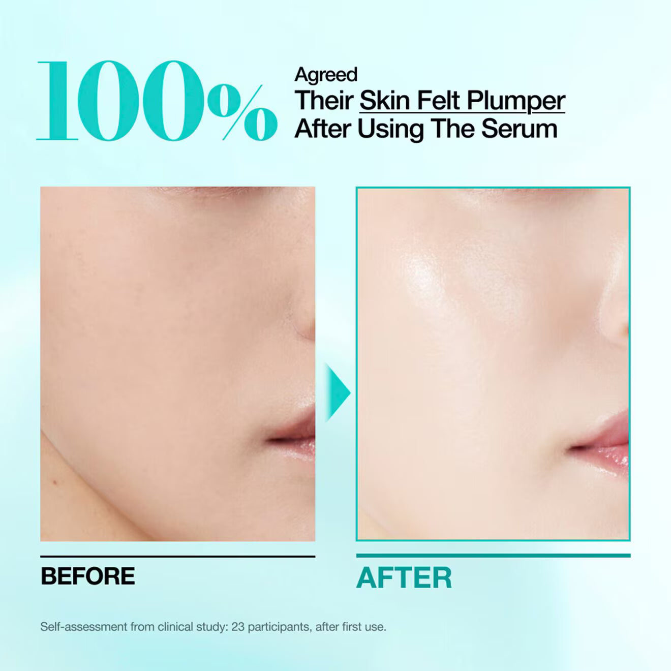 Mini for Plumping